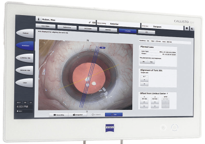 callisto-eye-from-zeiss-gradient-transformed callisto-eye-from-zeiss-gradient-transformed
